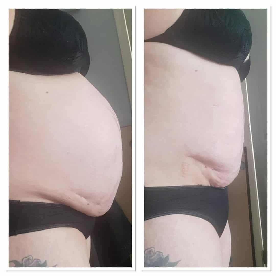L-Carnitine Fat-Burning Shots β Ready-Made Liquid Slimming Boost
