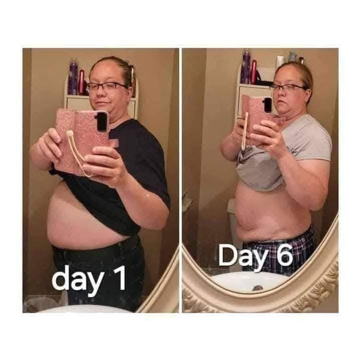 L-Carnitine Fat-Burning Shots β Ready-Made Liquid Slimming Boost