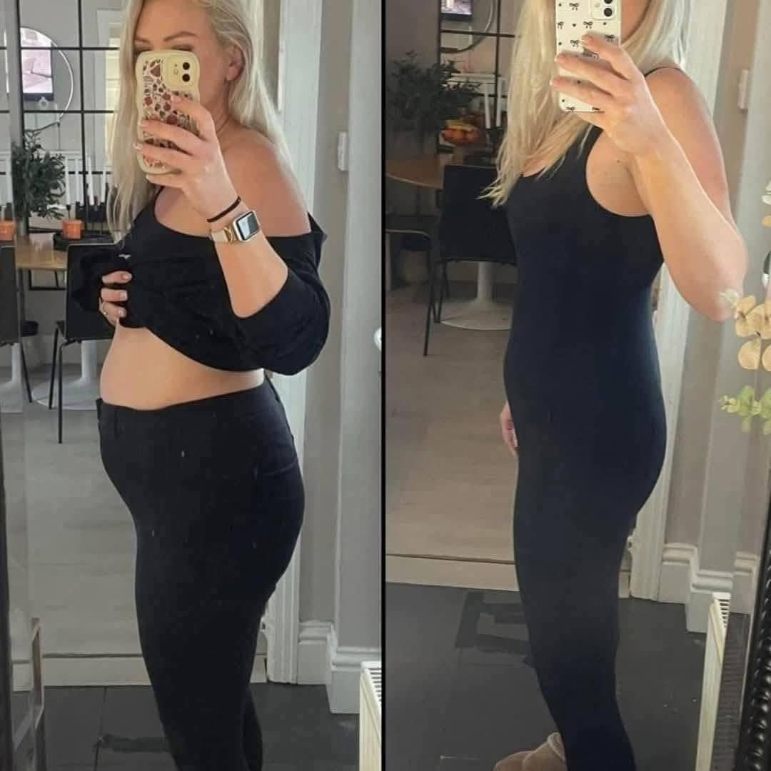 L-Carnitine Fat-Burning Shots β Ready-Made Liquid Slimming Boost