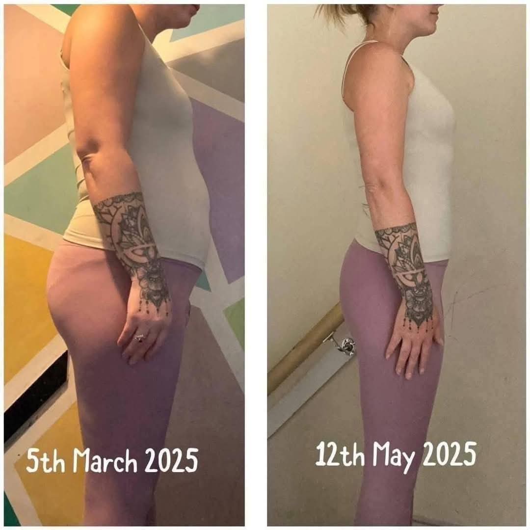 L-Carnitine Fat-Burning Shots β Ready-Made Liquid Slimming Boost