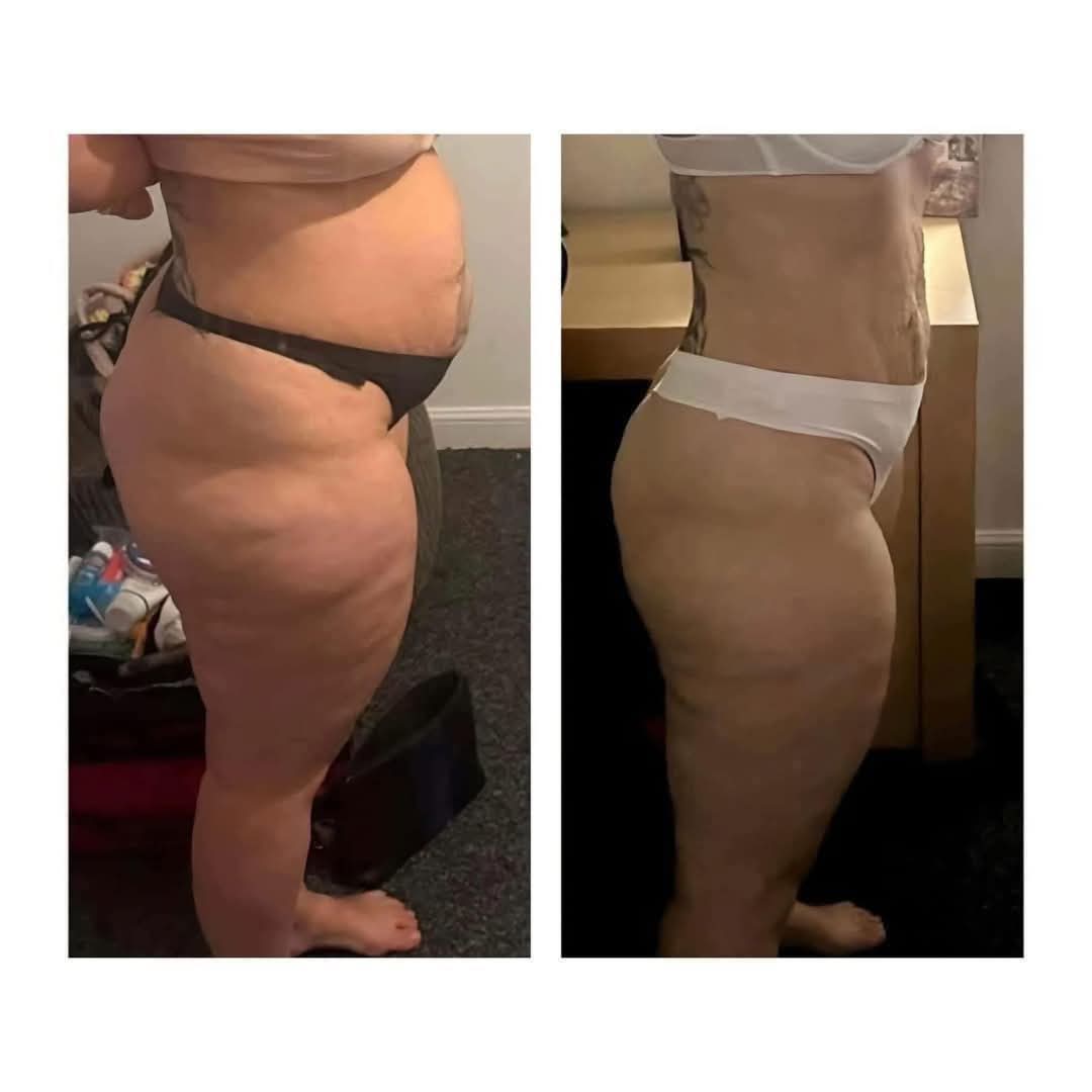 L-Carnitine Fat-Burning Shots β Ready-Made Liquid Slimming Boost