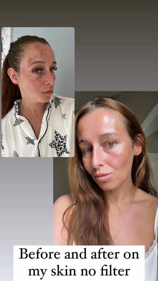 💧 Collagen Beauty Shots – Cranberry Glow-Up