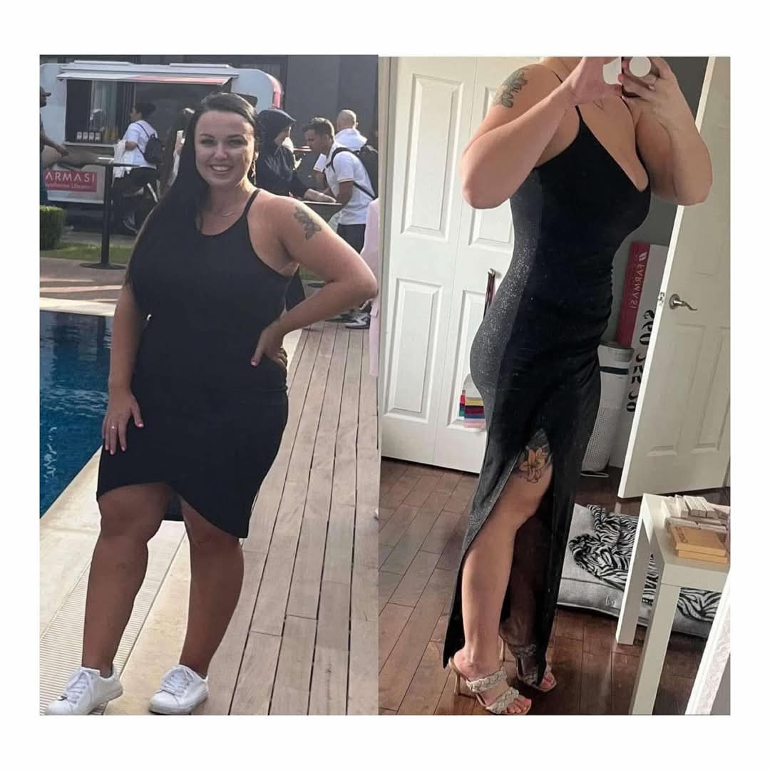 L-Carnitine Fat-Burning Shots β Ready-Made Liquid Slimming Boost