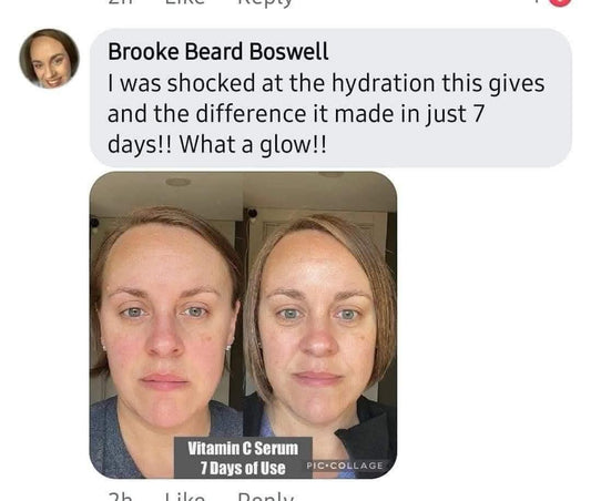 ✨ Vitamin C Glow Serum – Brighten & Boost Your Skin