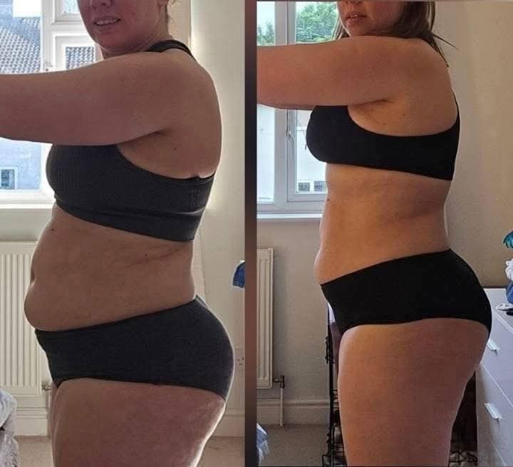 L-Carnitine Fat-Burning Shots β Ready-Made Liquid Slimming Boost