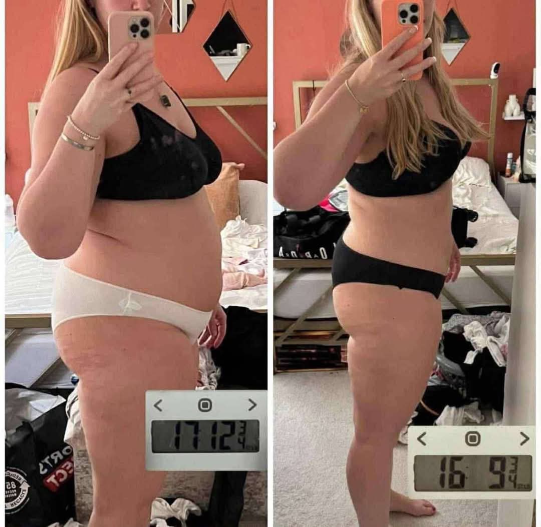 L-Carnitine Fat-Burning Shots β Ready-Made Liquid Slimming Boost