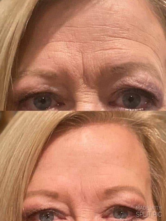 ✨ Age Reversist Miracle Cream – Botox-in-a-Sachet ✨