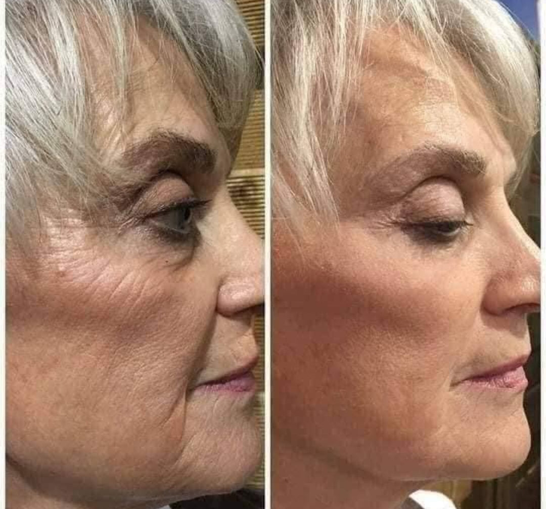 Skincare & Anti-aging