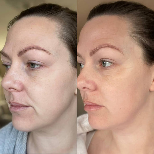 💧 Collagen Beauty Shots – Cranberry Glow-Up
