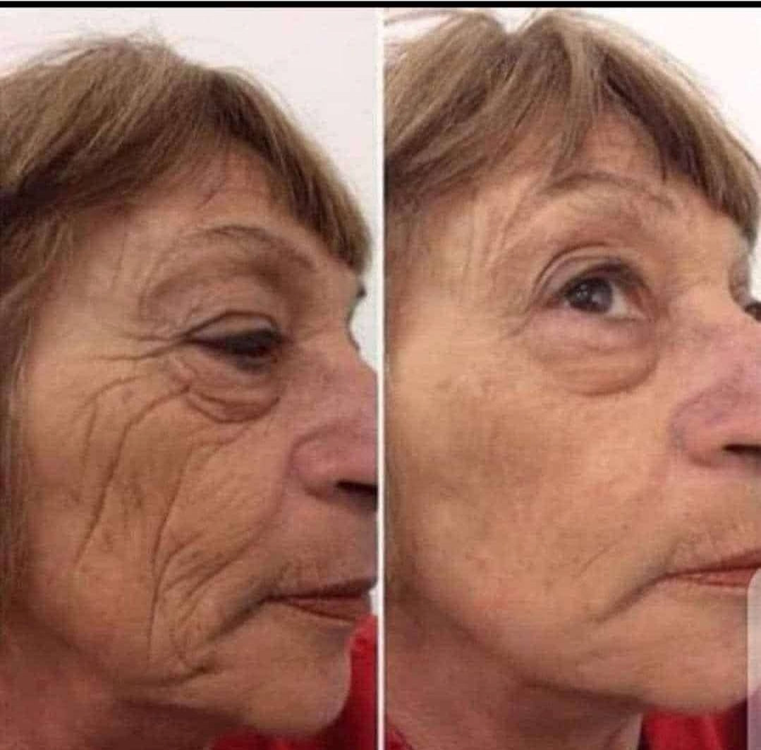 ✨ Age Reversist Miracle Cream – Botox-in-a-Sachet ✨