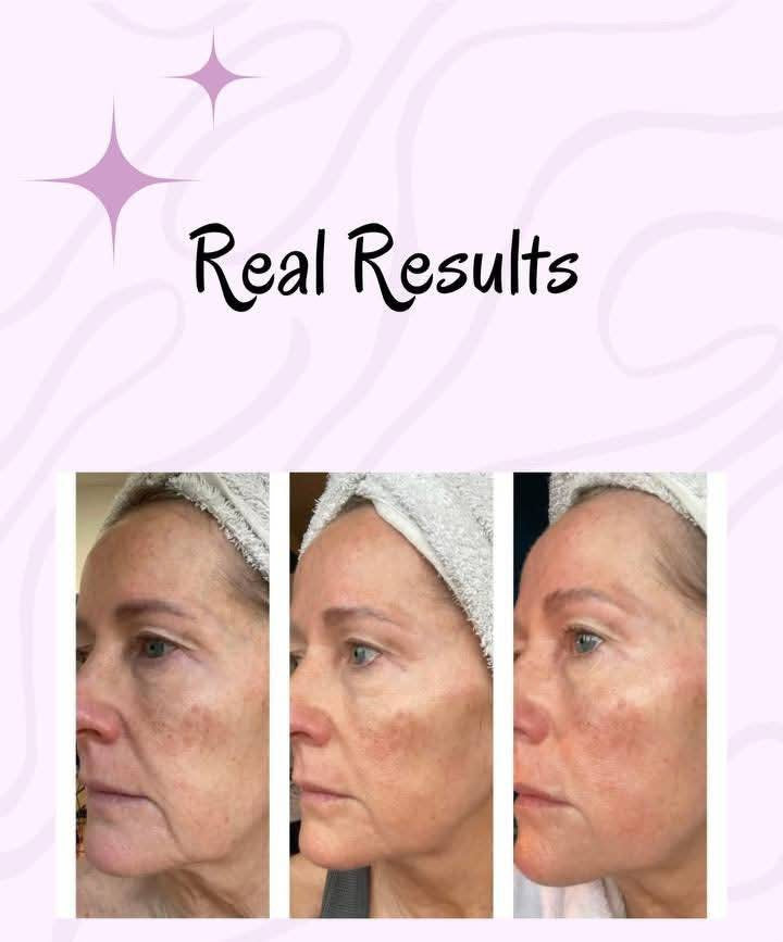 💧 Collagen Beauty Shots – Cranberry Glow-Up