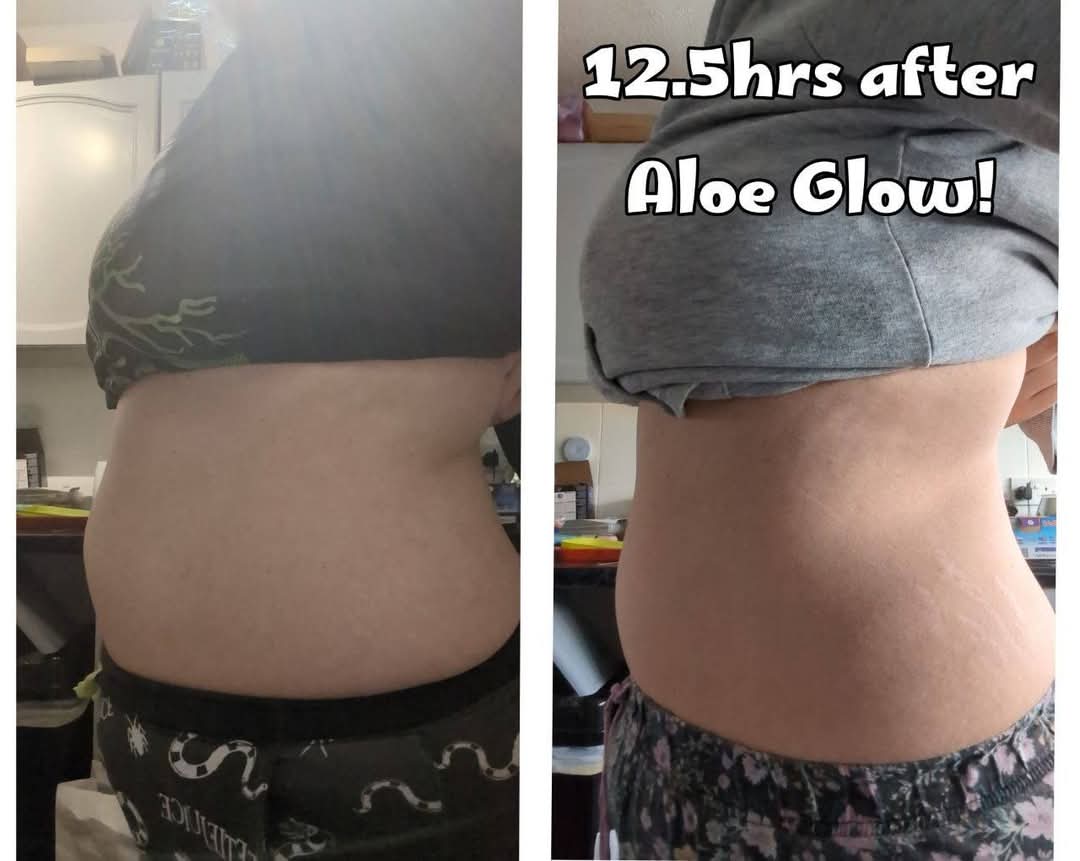 🌿 Aloe Glow – The Daily Glow-Up Elixir