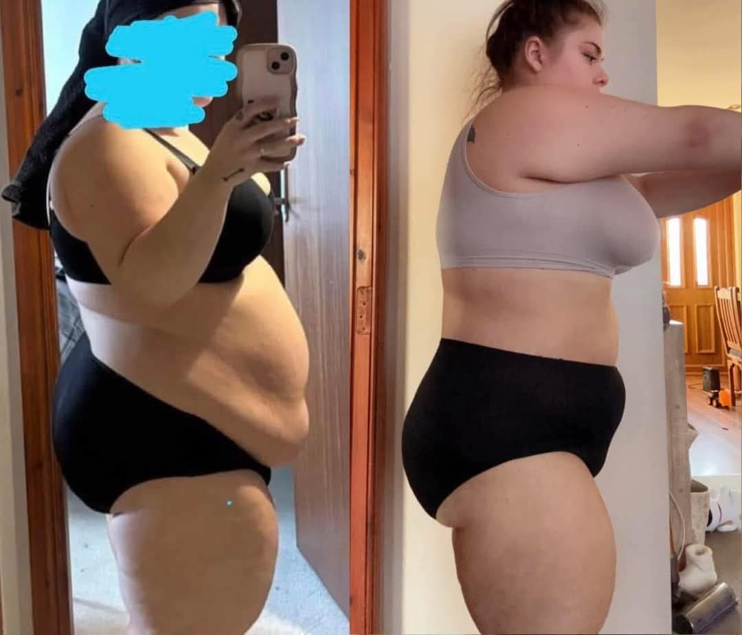 Apple Cider vinegar gummies