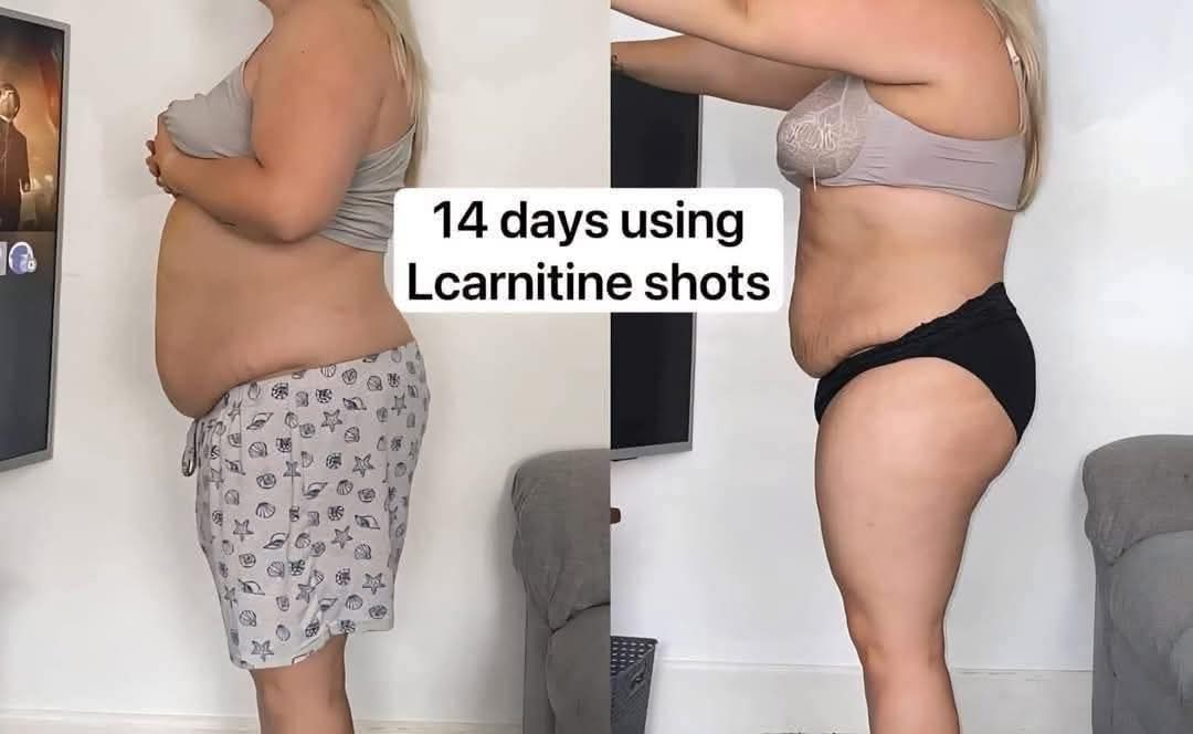L-Carnitine Fat-Burning Shots – Ready-Made Liquid Slimming Boost