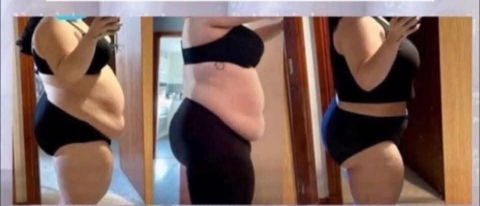 Apple Cider vinegar gummies