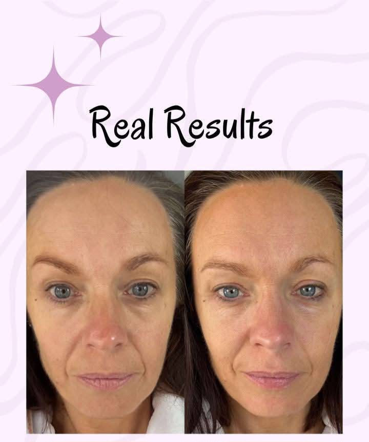 💧 Collagen Beauty Shots – Cranberry Glow-Up