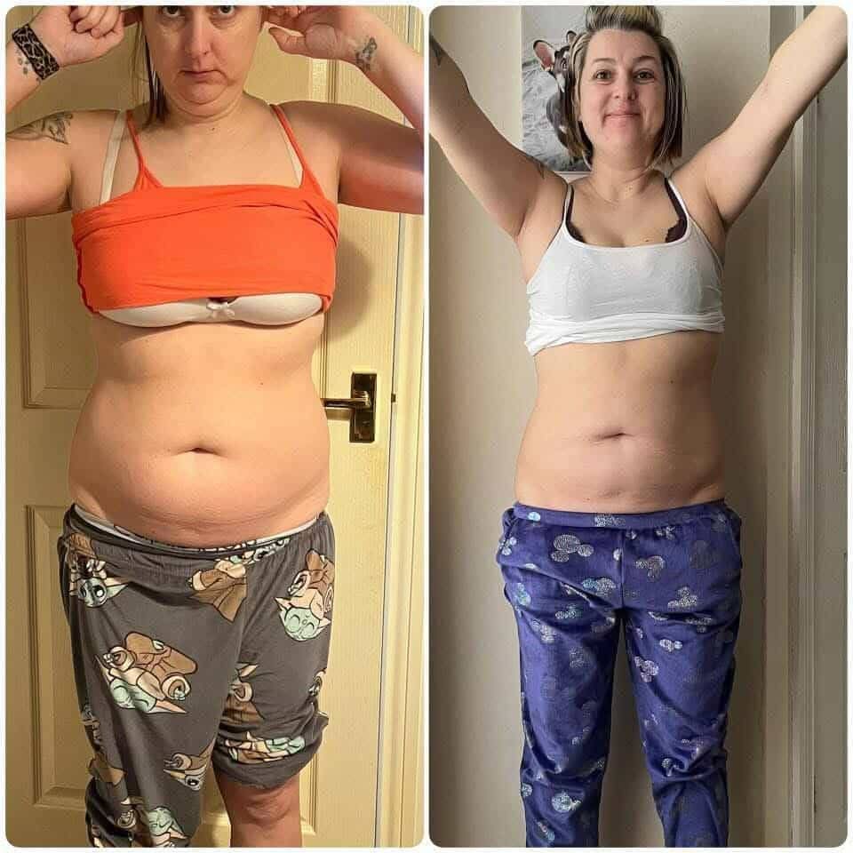 Apple Cider vinegar gummies