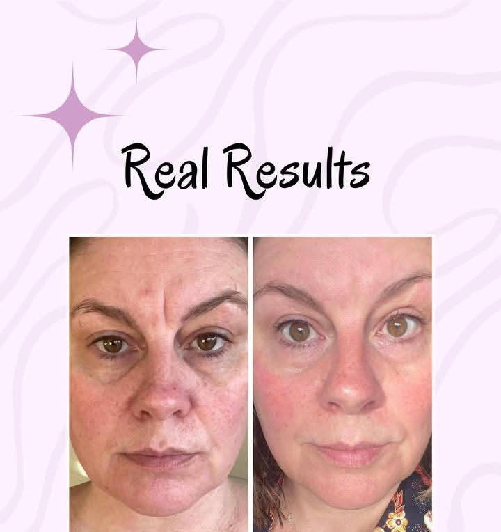 💧 Collagen Beauty Shots – Cranberry Glow-Up