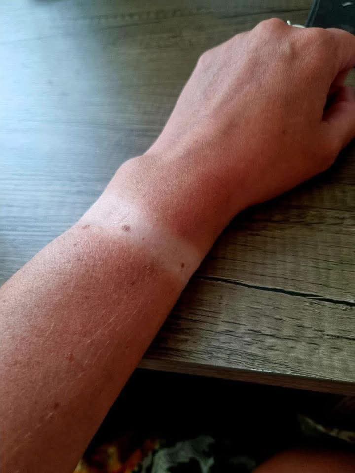 🌞Viral Tanning Oil – Golden Glow Accelerator🌞