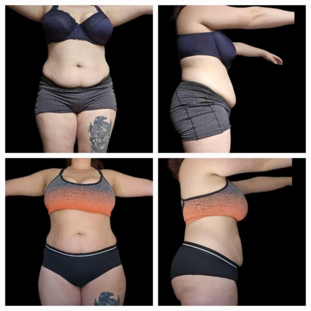 Fat burning, weight loss coffee ☕️