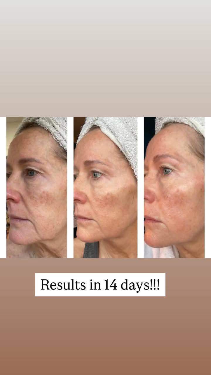 💧 Collagen Beauty Shots – Cranberry Glow-Up
