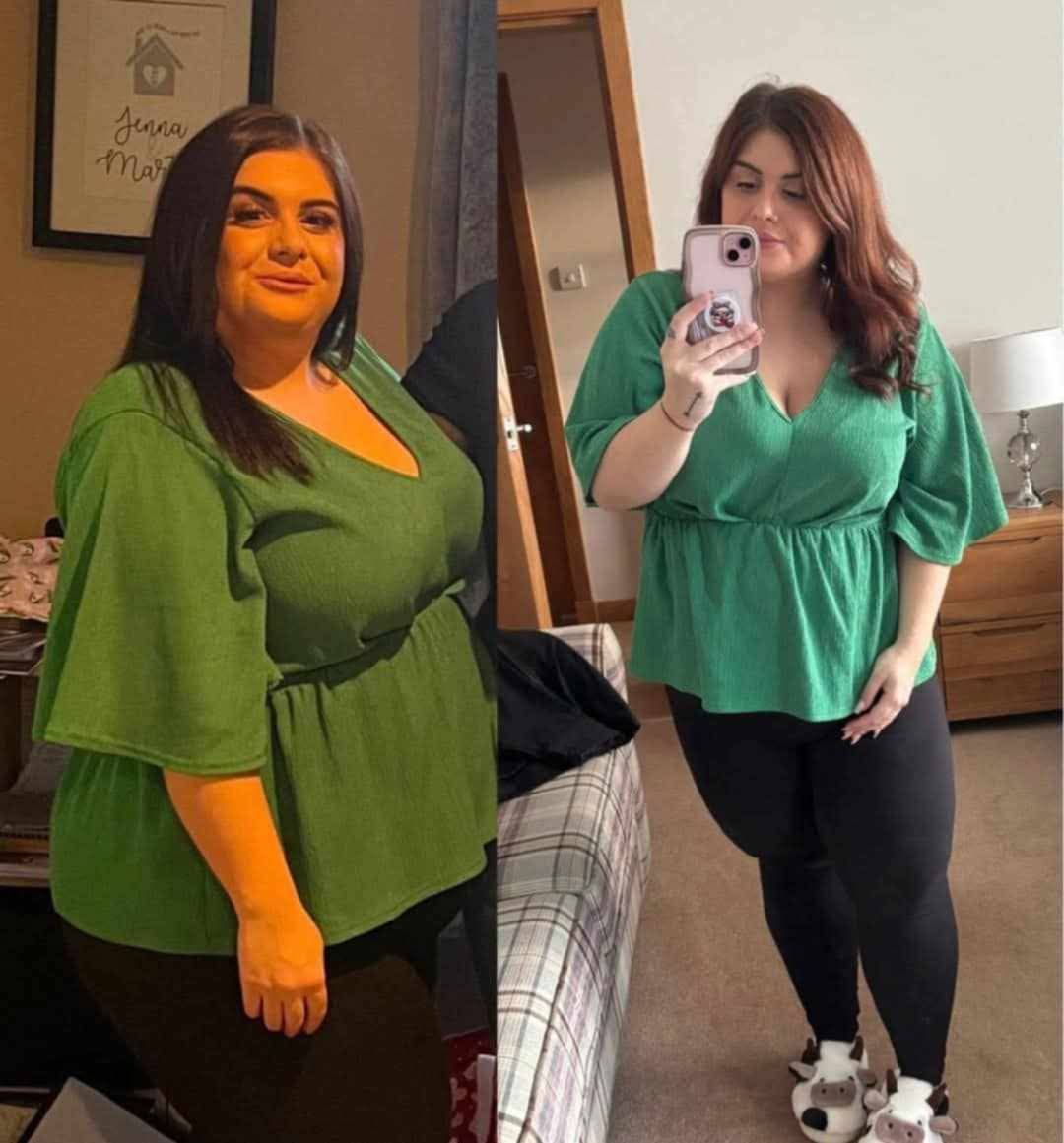 Apple Cider vinegar gummies