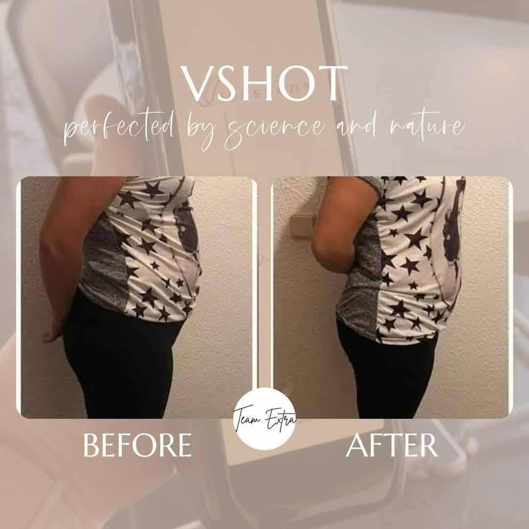 V-shot fat burn & Energy boost